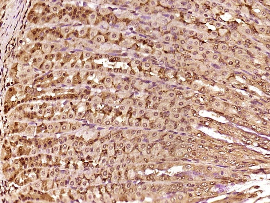 Anti-HMGB1 Polyclonal Antibody 2