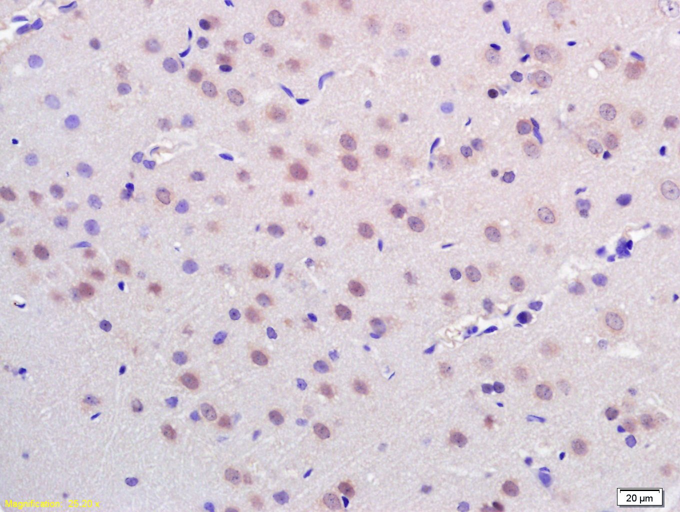 Anti-HDAC3 Polyclonal Antibody