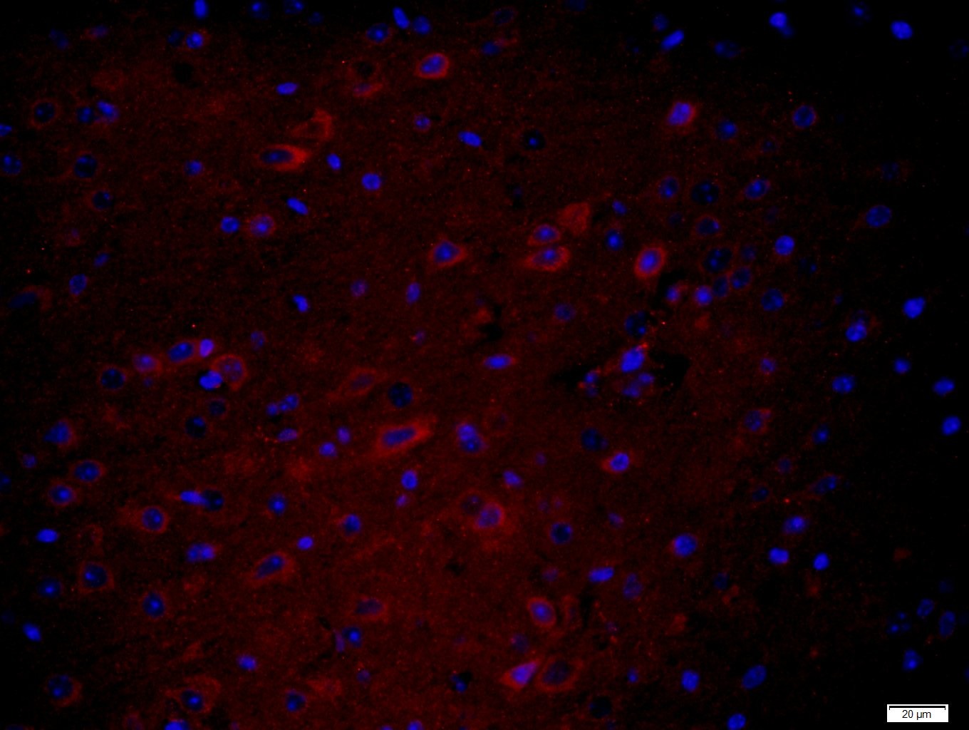 Anti-HEG1 Polyclonal Antibody