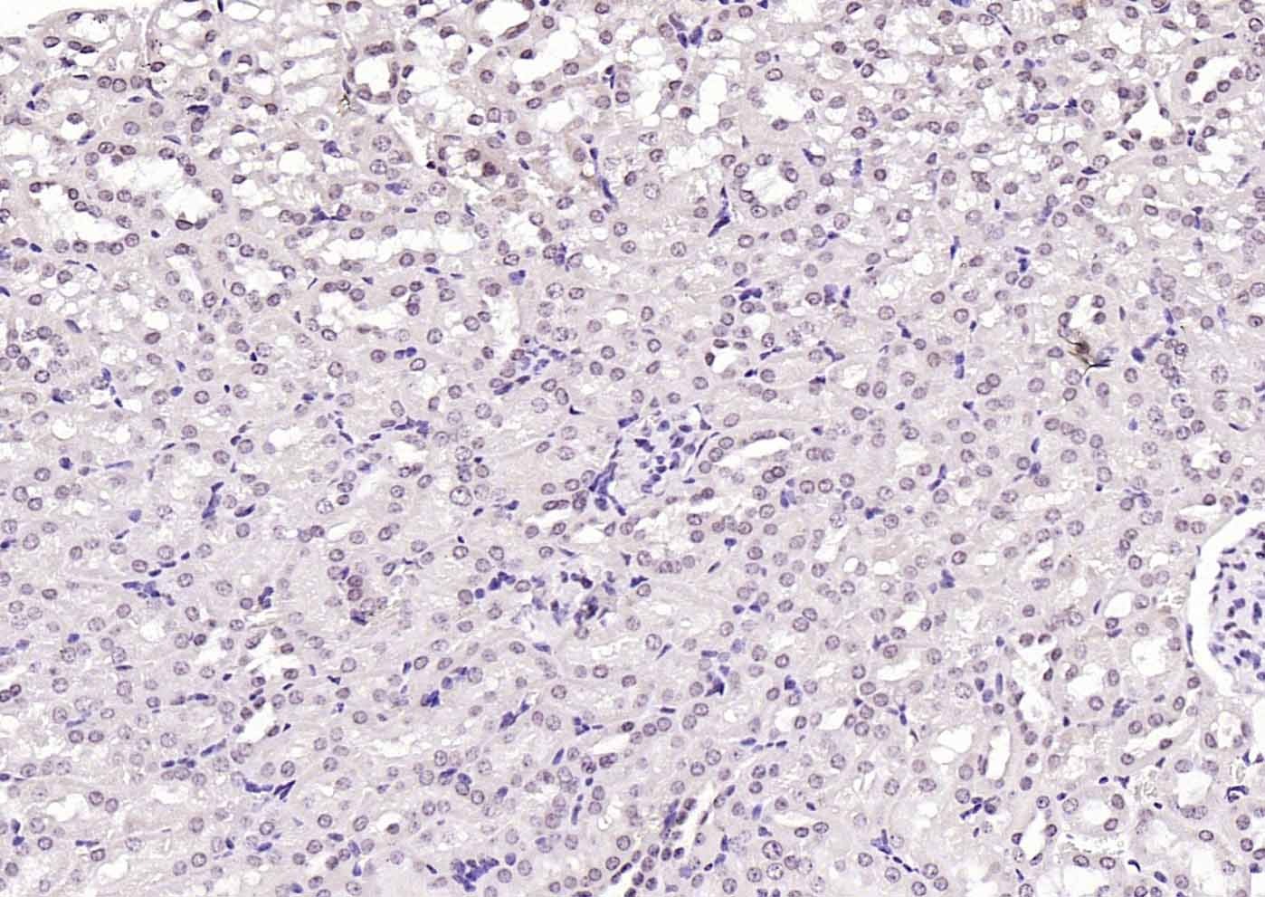 Anti-HMGB1 Polyclonal Antibody 2