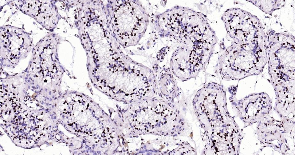 Histone H3 Nuclear Loading Control Polyclonal Antibody