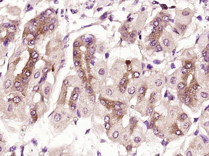 Anti-HK2 Polyclonal Antibody