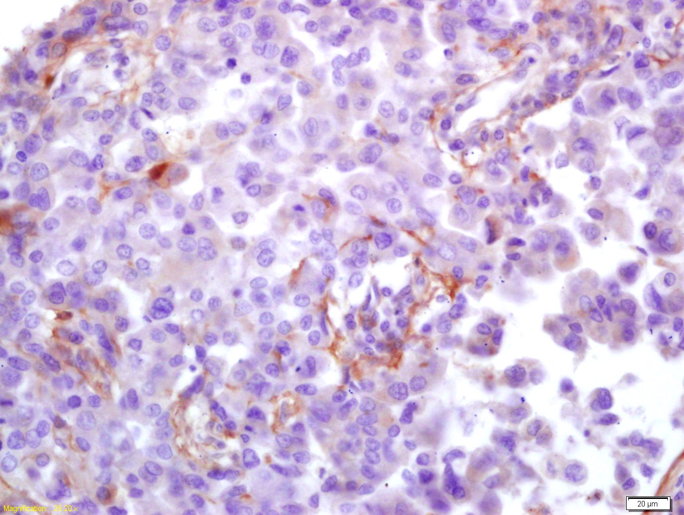 Anti-HCMV pp65 Polyclonal Antibody