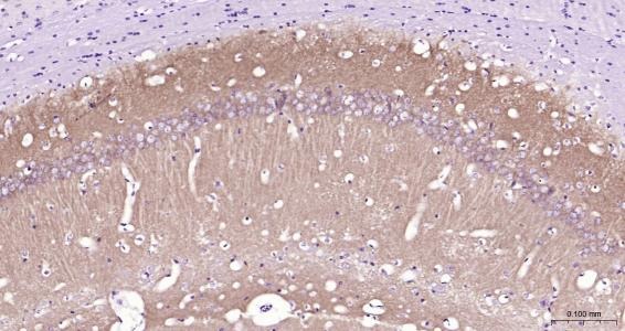 Anti-GRIA1 Polyclonal Antibody