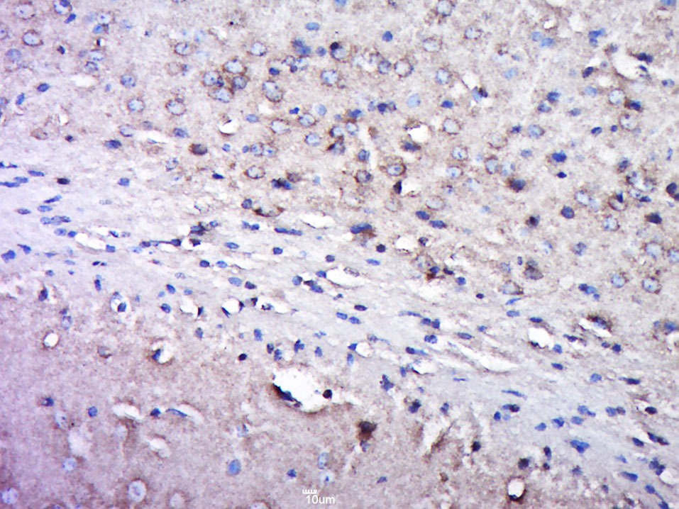 Anti-GRIA2 Polyclonal Antibody