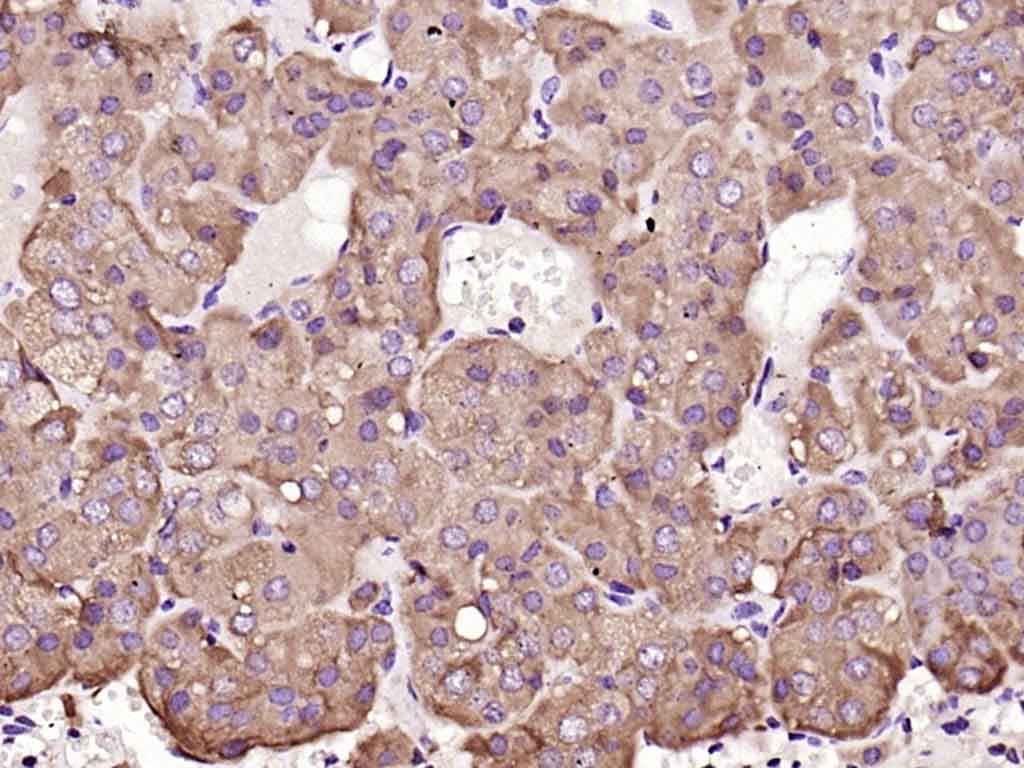 Anti-gp130/IL6ST Polyclonal Antibody