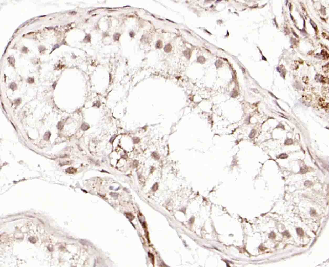 Anti-GRP75 Polyclonal Antibody