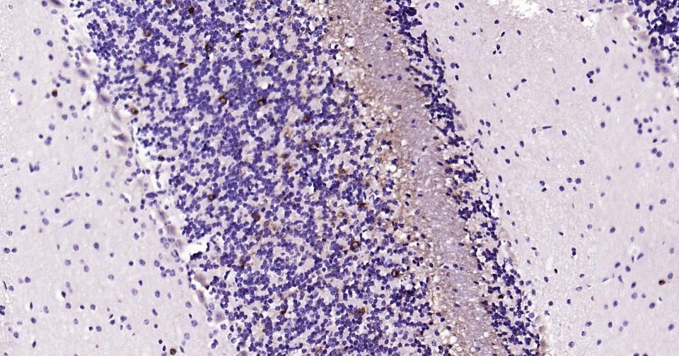 Anti-GRIN1 Antibody (5R681)