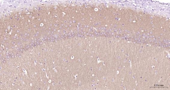 Anti-GRIA1 Polyclonal Antibody