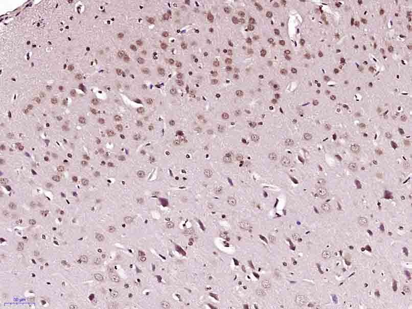 Anti-HFH4 Polyclonal Antibody
