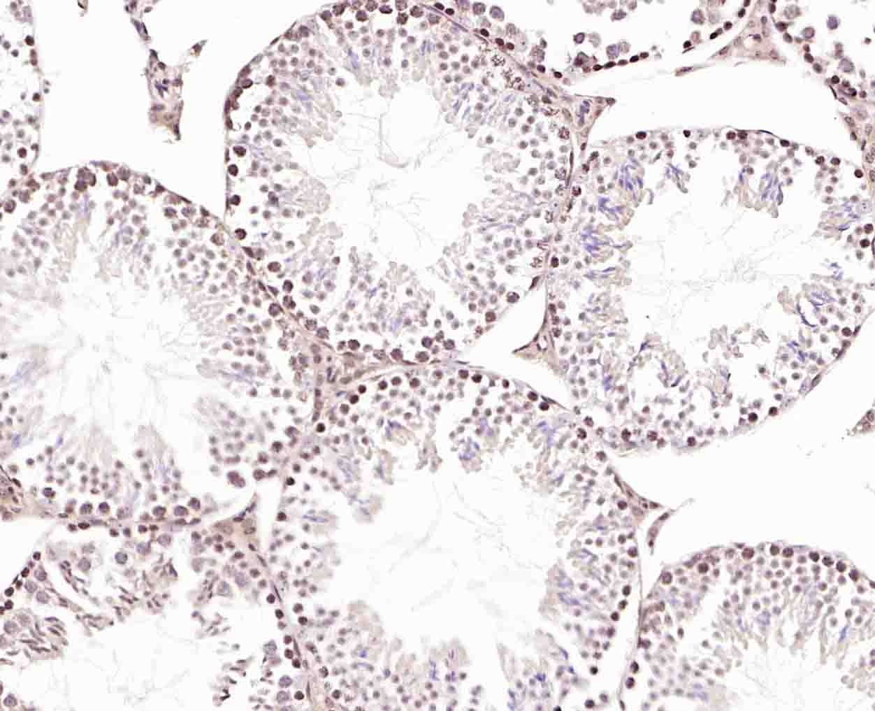 Anti-GRP75 Polyclonal Antibody