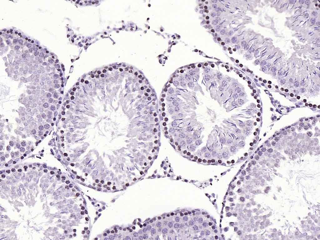 Anti-HFH4 Polyclonal Antibody