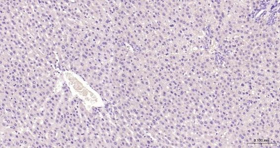 Anti-GRIA1 Polyclonal Antibody