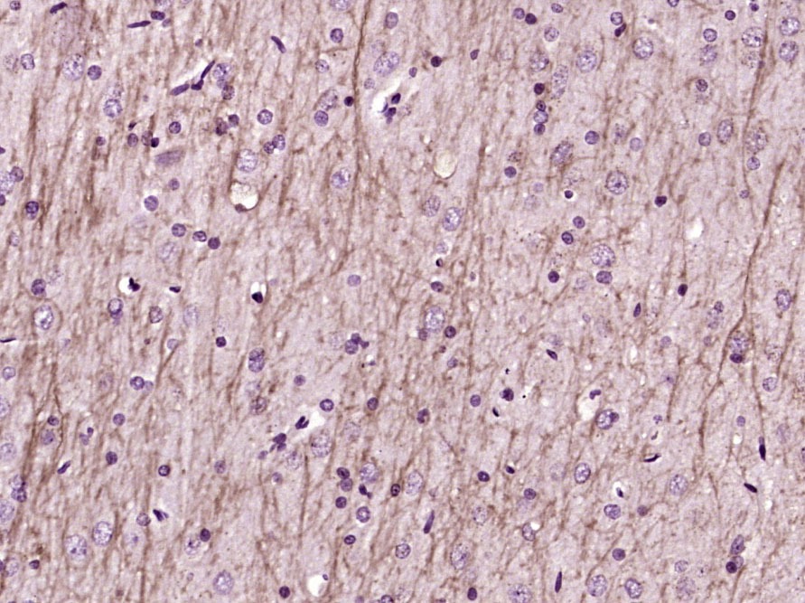 Anti-GRIN1 Polyclonal Antibody
