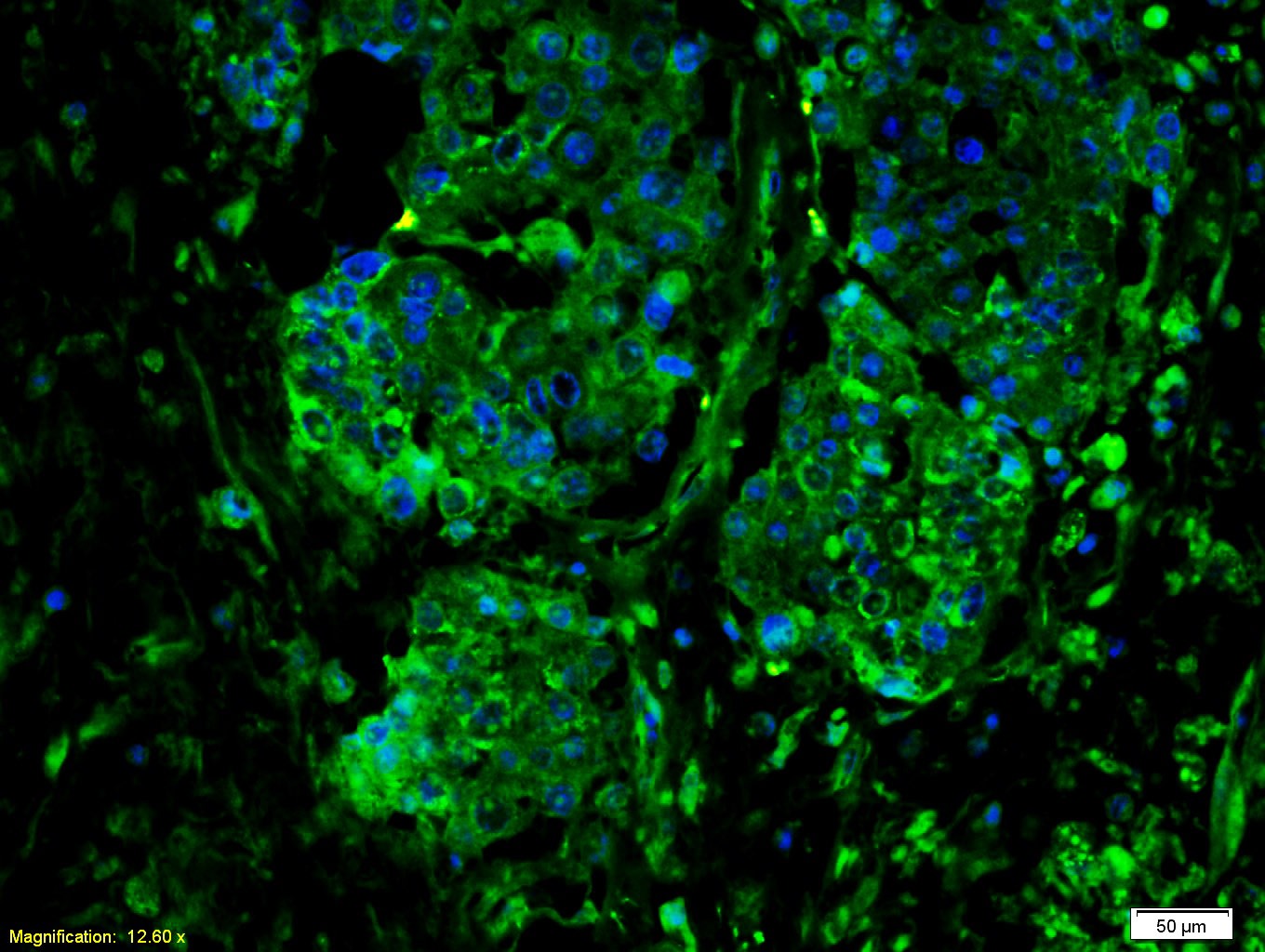 Anti-gp130/IL6ST Polyclonal Antibody