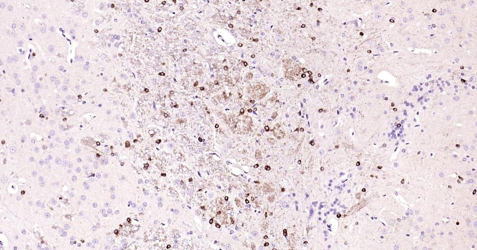 Anti-GRIN1 Antibody (5R681)