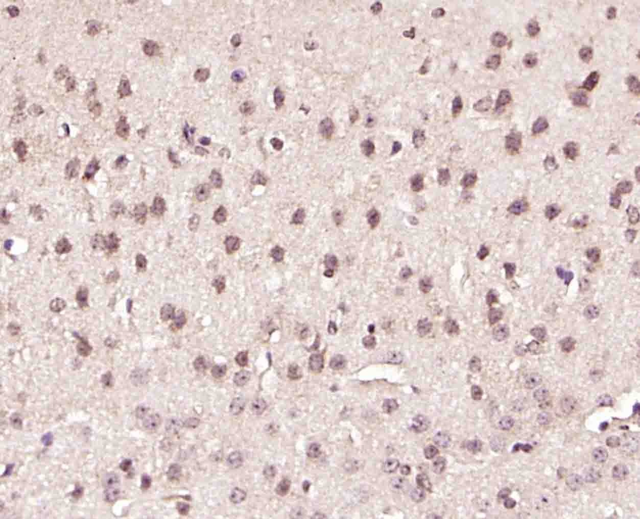 Anti-GRP75 Polyclonal Antibody