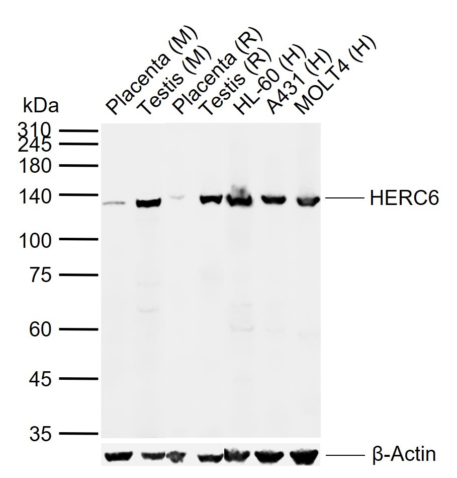 Anti-HERC6 Polyclonal Antibody