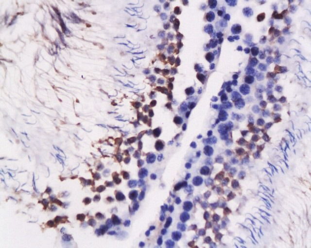 Anti-HSPA5 Polyclonal Antibody