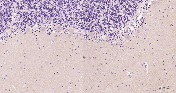 Anti-GRIA1 Polyclonal Antibody
