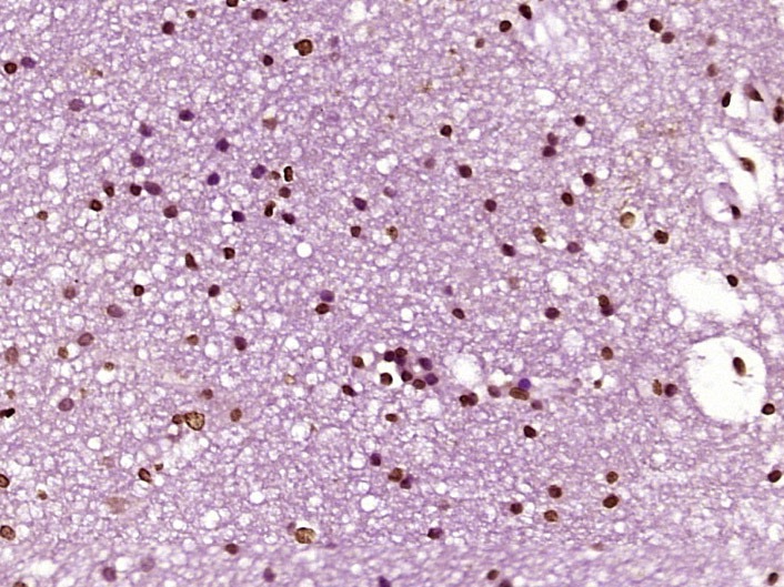 Anti-HFH4 Polyclonal Antibody