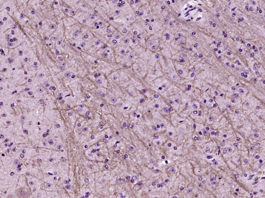 Anti-GRIN1 Polyclonal Antibody