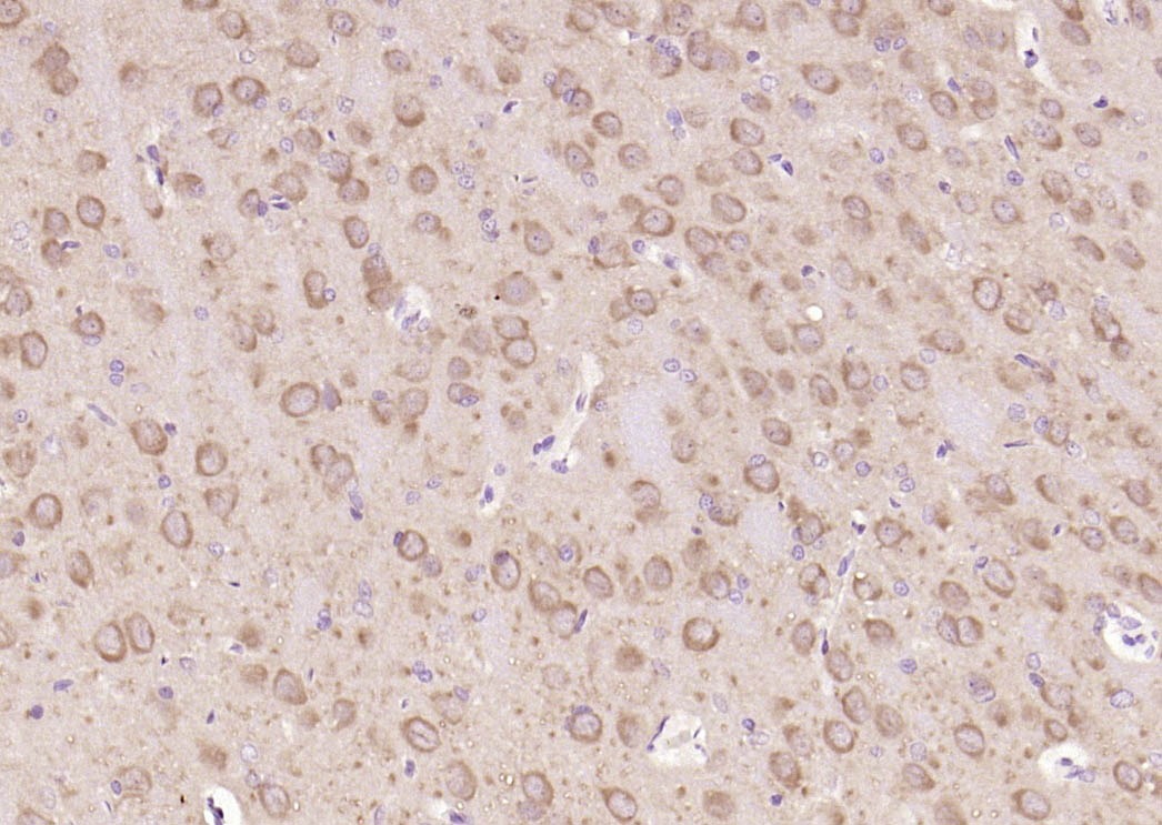 Anti-GSK3B Antibody (5W152)