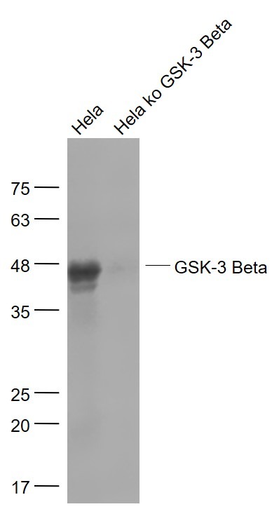 Anti-GSK3B Antibody (5W152)