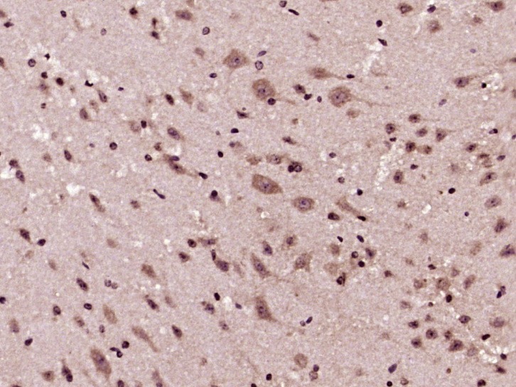 Anti-GSK3B Polyclonal Antibody 3