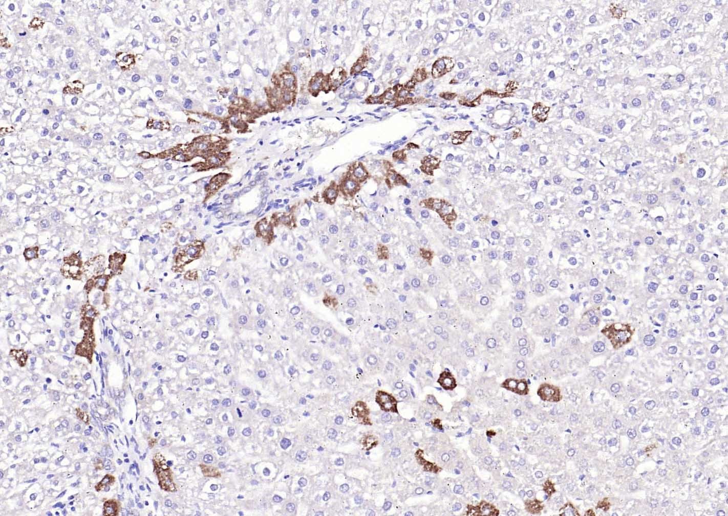 Anti-GPLD1 Polyclonal Antibody