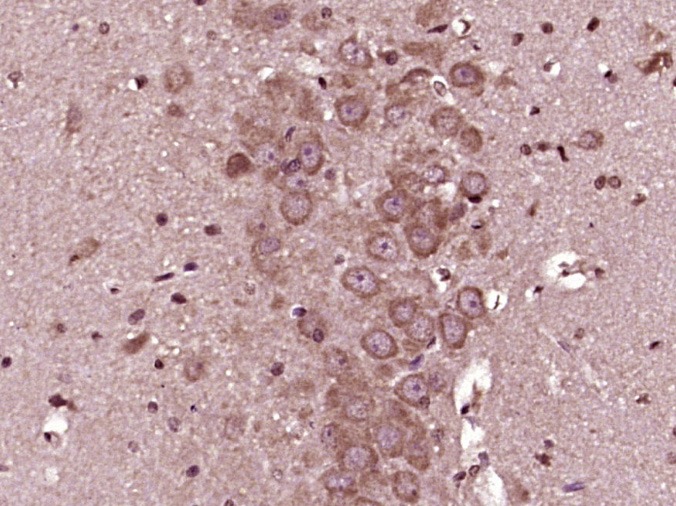 Anti-GSK3B Polyclonal Antibody 3