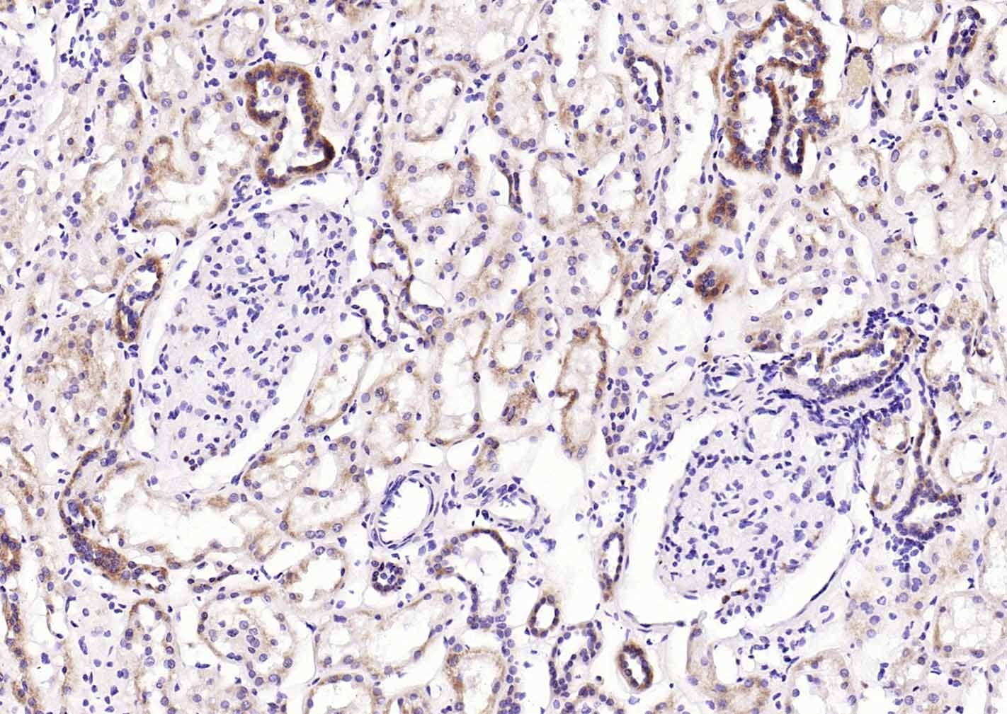 Anti-GPLD1 Polyclonal Antibody