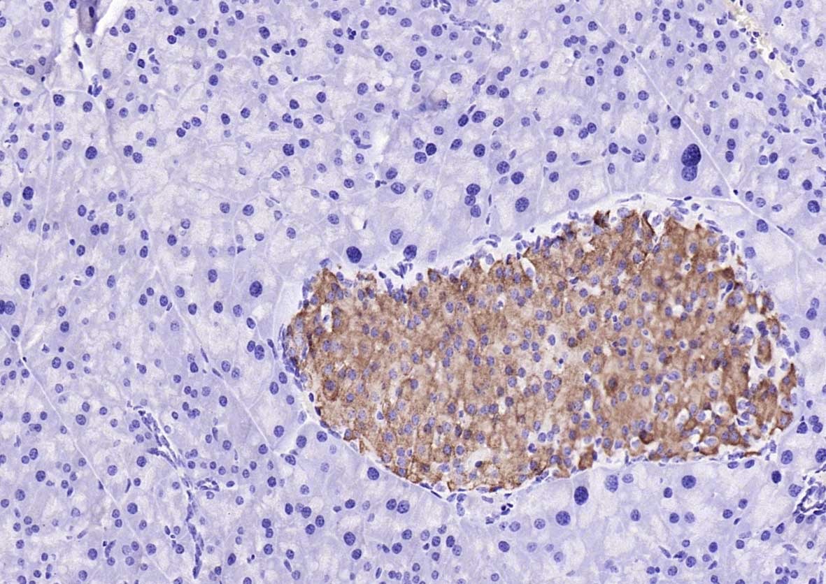Anti-GSK3B Polyclonal Antibody 3