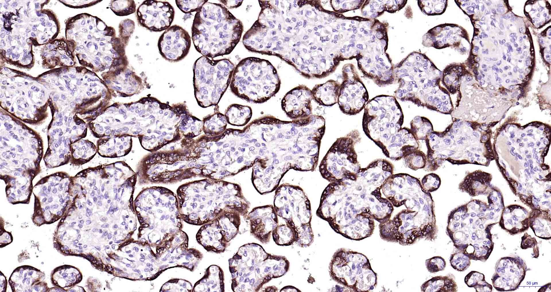 Anti-Chorionic Gonadotropin/CGA Antibody (3J474)
