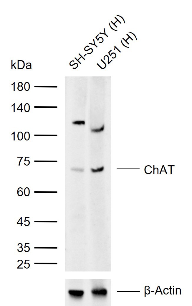 Anti-CHAT Polyclonal Antibody