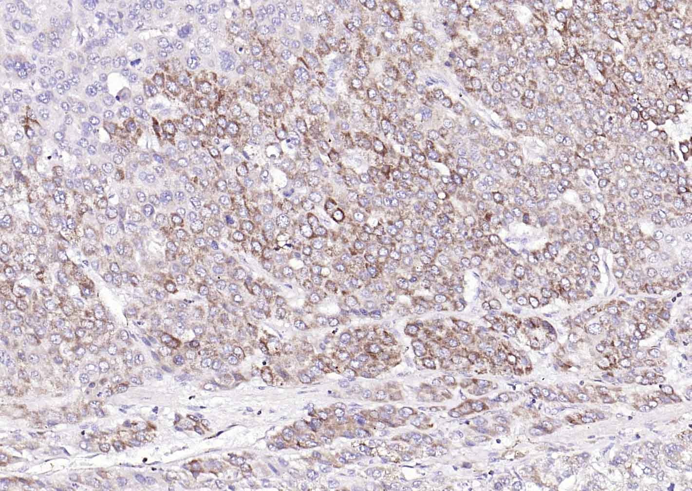 COX4I1 Mitochondrial Loading Control Antibody (5Z89)