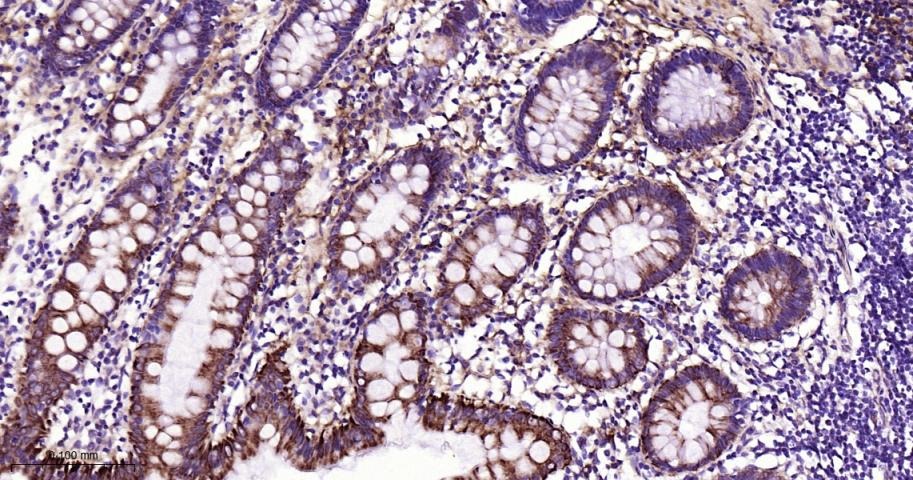 Anti-CPT1A Polyclonal Antibody