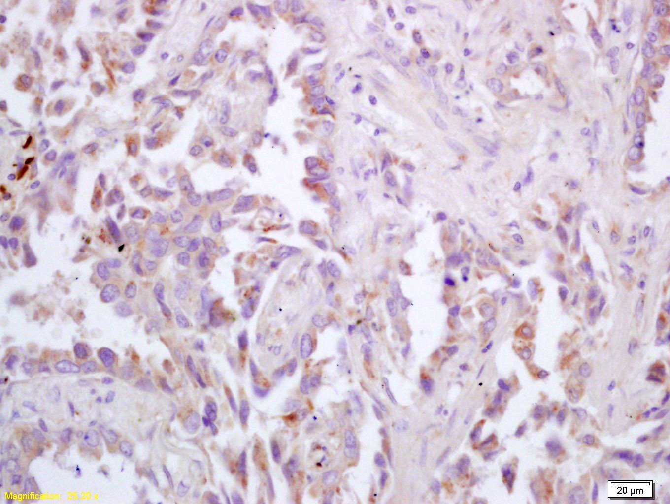 Anti-CHRM3 Polyclonal Antibody