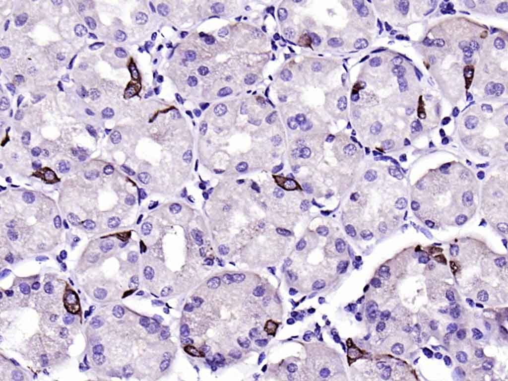 Anti-CHGA Polyclonal Antibody