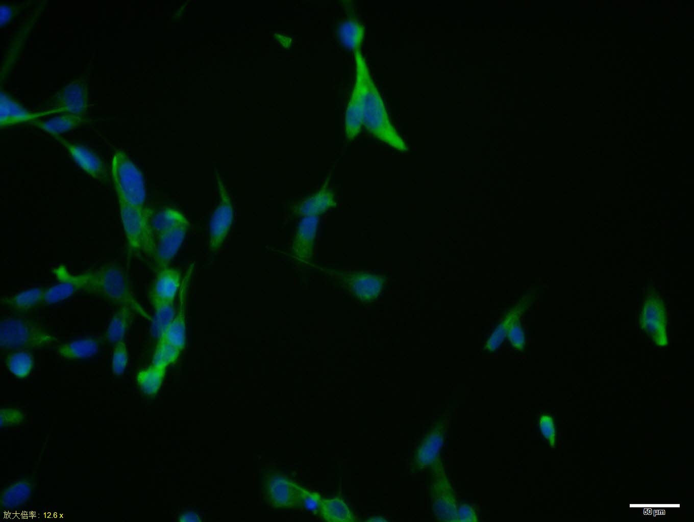 Anti-YKL-40/CHI3L1 Polyclonal Antibody 2