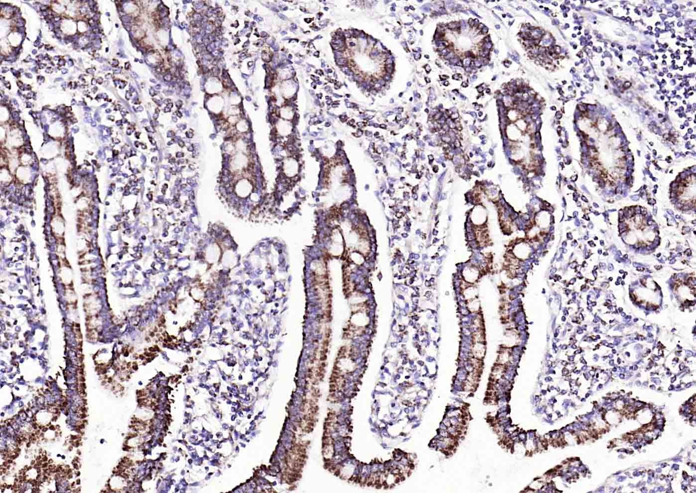 COX4I1 Mitochondrial Loading Control Antibody (5Z89)
