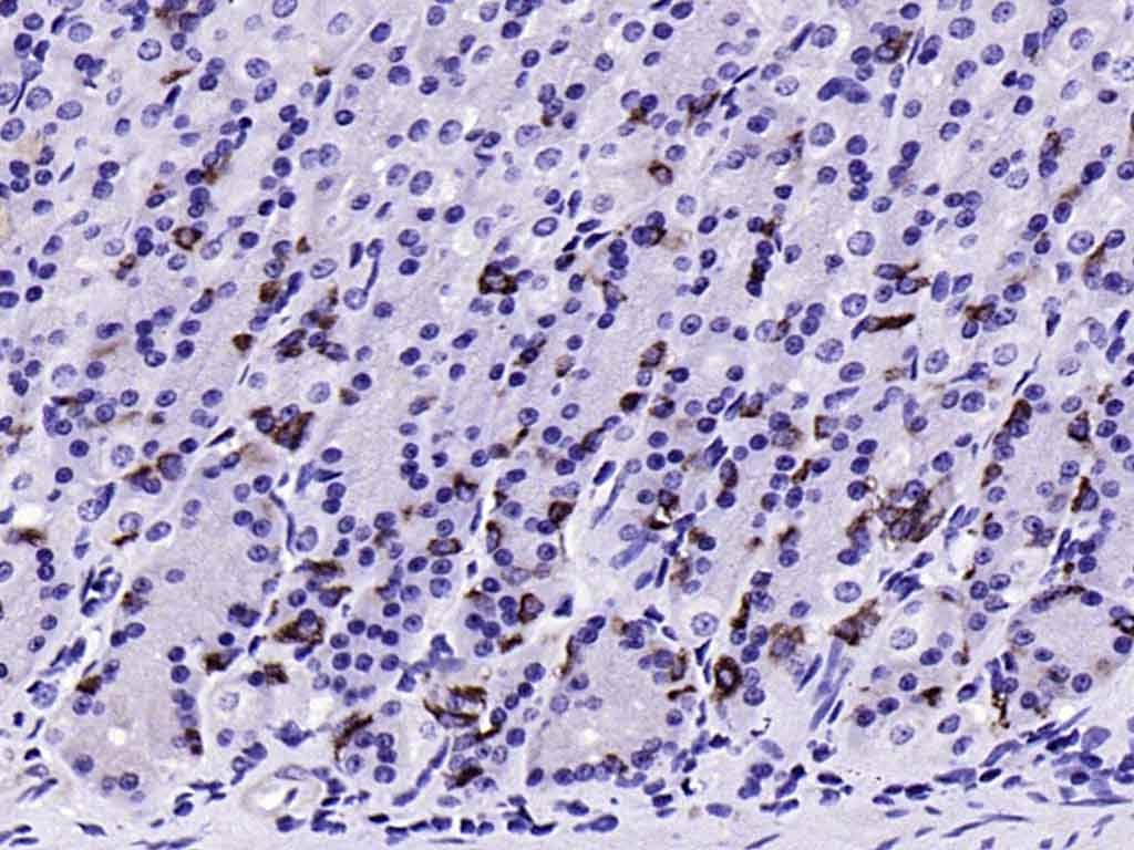 Anti-CHGA Polyclonal Antibody