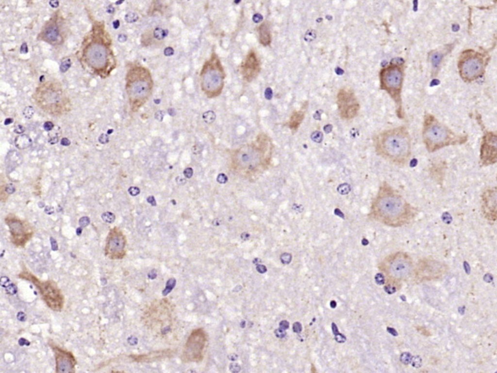 Anti-C-Kit Polyclonal Antibody