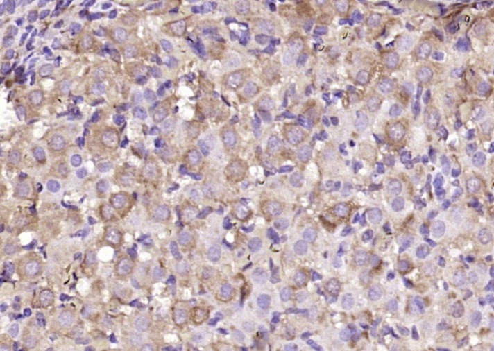Anti-CHST2 Polyclonal Antibody