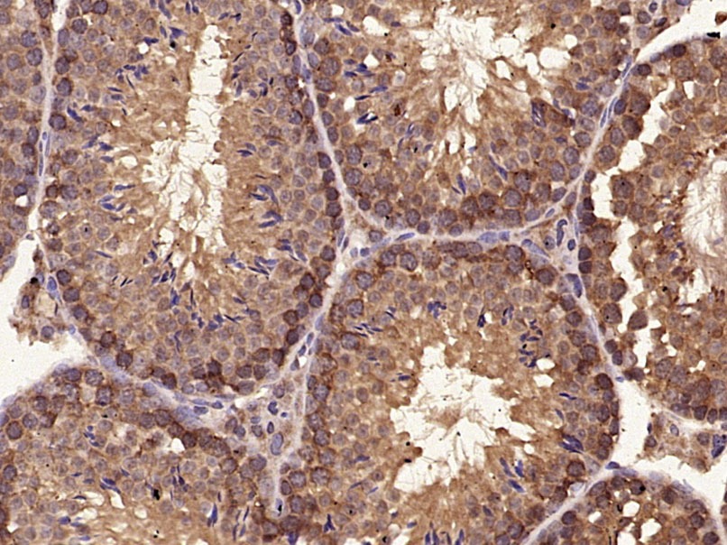 Anti-C-Kit Polyclonal Antibody