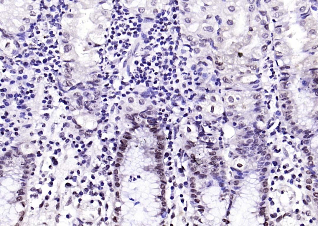 Anti-CIDEC Polyclonal Antibody