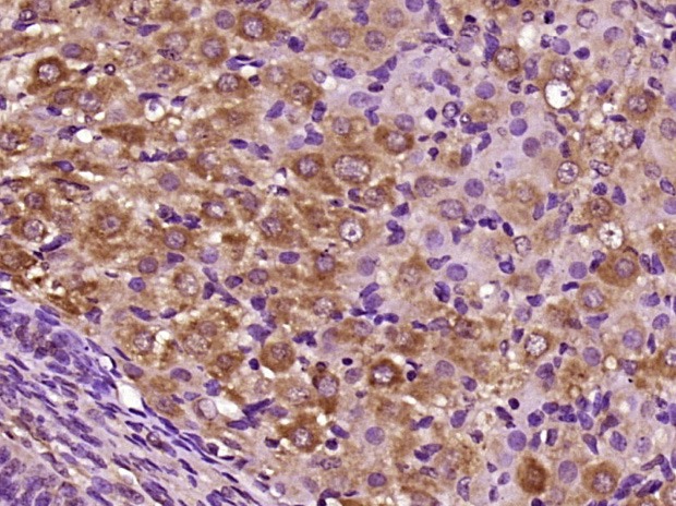 Anti-CILP Polyclonal Antibody