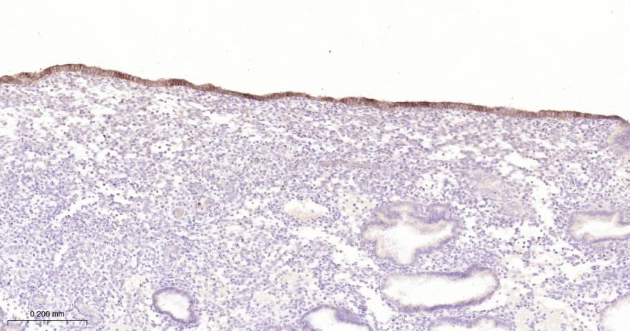 Anti-Claudin-1 Antibody (2P425)