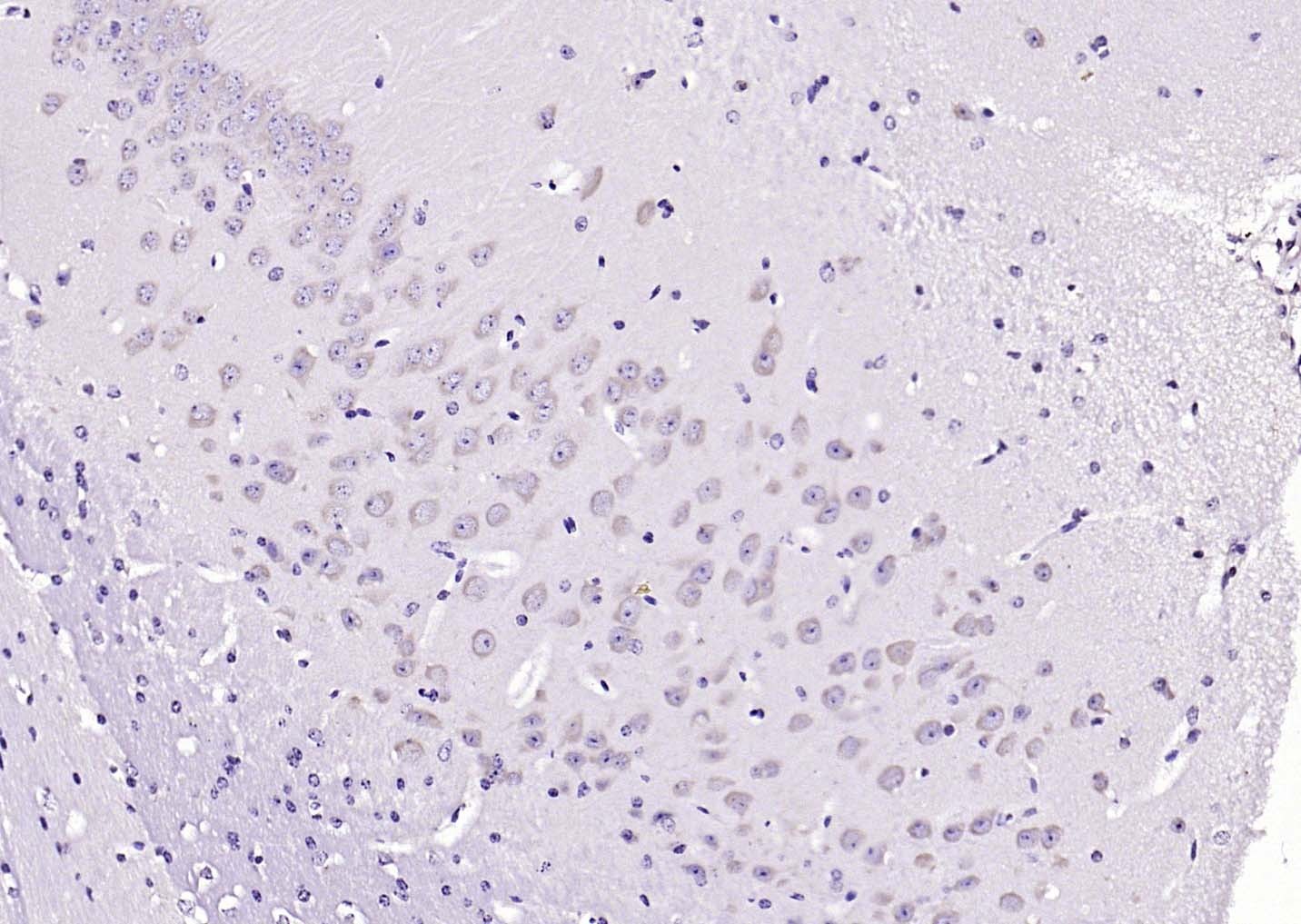 Anti-CRHR1 Polyclonal Antibody