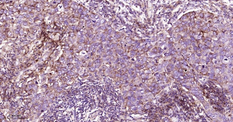 Anti-CPT1A Polyclonal Antibody